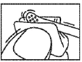 Ilustración lineal en negro que muestra una mano sosteniendo un aplicador médico colocado sobre la cadera o el abdomen de un paciente