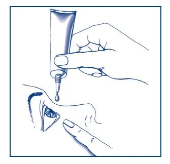 A hand holding a medication tube, from which a drop is flowing directly into the eye of a person depicted in profile as a blue sketch