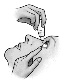 Mano che tiene una piccola boccetta e applica una goccia di farmaco nell'occhio di una persona, mentre l'altra mano delicatamente tira verso il basso la palpebra inferiore