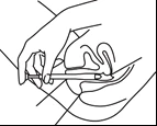 Disegno che rappresenta una mano che impugna un iniettore, applicato sulla regione dell'anca e della natica per somministrare un farmaco