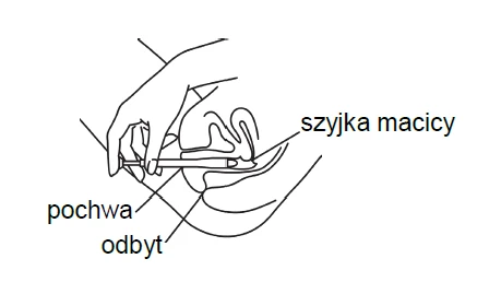 Schemat anatomiczny przedstawiający dłoń trzymającą aplikator wprowadzany do pochwy, z podpisami szyjka macicy, pochwa oraz odbyt