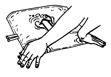 Disegno che mostra due mani che tendono e allargano un lembo di pelle per preparare il sito di somministrazione del farmaco o per effettuare un'incisione