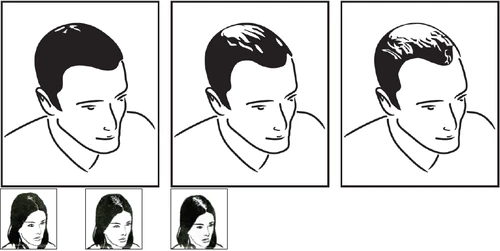Three illustrations showing a man's head from different angles and three smaller portraits of a woman's head at the bottom of the image