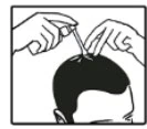 Two hands holding an applicator and applying it to the top of a person's head to administer medication to the scalp
