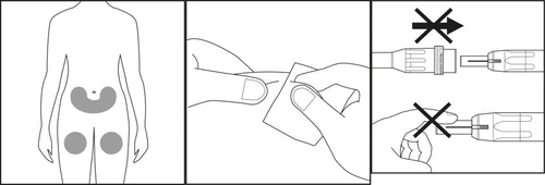 Schematic diagram showing a human silhouette with marked injection sites on the abdomen and thighs, instructions for applying a patch, and incorrect ways of connecting device components