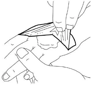 Disegno che raffigura mani che applicano una striscia di cerotto o medicazione su una lesione cutanea situata sul dorso della mano