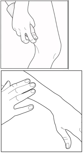 Dibujo que muestra una mano sosteniendo el aplicador en el muslo y la otra mano apoyada en el antebrazo para estabilizar el brazo
