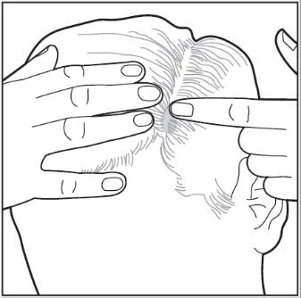 Dibujo que muestra manos tocando las sienes y zonas cercanas a la cabeza de una persona, indicando los lugares de aplicación del medicamento o puntos de presión en la frente y junto a la oreja