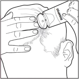 Dibujo que muestra manos sosteniendo un frasco de champú y aplicando el producto sobre el cuero cabelludo y el cabello de una persona vista de perfil