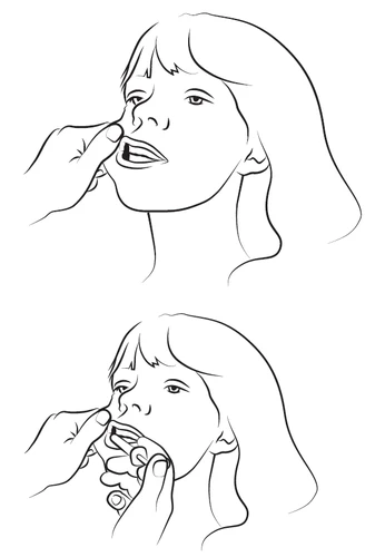 Illustration showing a hand pulling down a woman's lower lip and another hand holding small tablets near her mouth