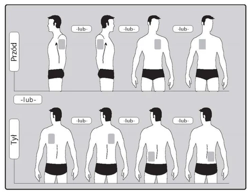 Схема, що показує різні положення тіла для введення ліків, з силуетами чоловіків спереду та ззаду, із позначеними місцями на животі та спині