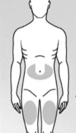 Schematic human silhouette with gray areas indicating pain in the lower abdomen and both thighs