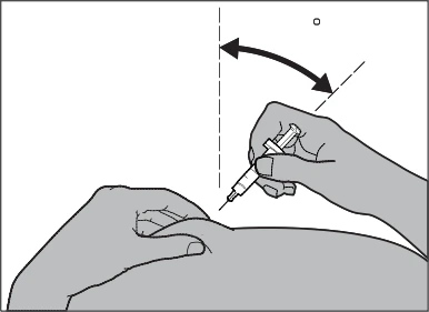 Hand holding a syringe at an angle of inclination indicated by a dashed line and a black arrow above the patient's arm