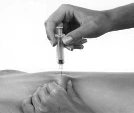 Hand holding a syringe with a needle preparing to administer an injection into the back, while the other hand stretches the skin at the injection site