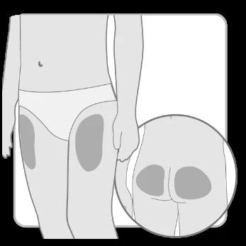 Schematic human figure with gray areas marked on the thighs and an enlarged view of the buttocks indicating injection sites