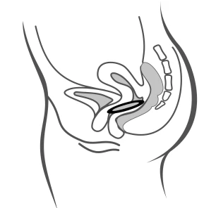 Schematic lateral section of the female pelvis showing the uterus, vagina, urinary bladder, rectum, lumbar spine, and sacrum