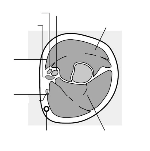 Cross-sectional schematic of a limb showing anatomical structures such as bone, muscle tissue, and subcutaneous layers