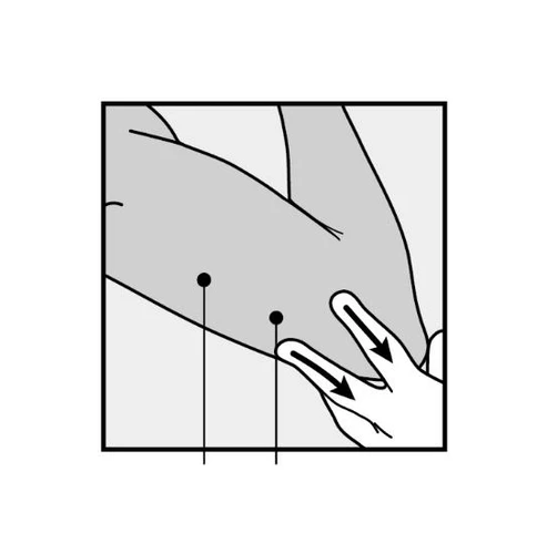 Schematic illustration showing a hand indicating two points on the thigh, connected by vertical lines with black dots on the skin