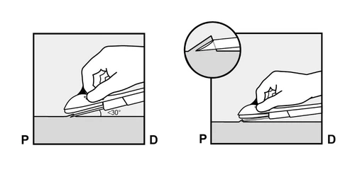 Schematic showing a hand holding a device at an angle less than 30 degrees relative to the surface, with a close-up of the tip during drug application
