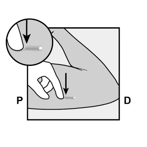 Schematic showing method of drug administration into the thigh, magnified view showing needle inserted perpendicularly to the skin along marked direction