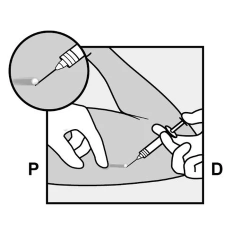 Hand holding a syringe inserting a needle into the thigh, magnified view of needle tip and letter designations P and D on sides of the schematic