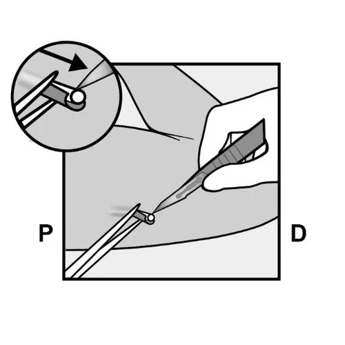 Schematic instruction for drug administration showing hand holding a syringe inserting needle into the skin at an angle, with magnified view of injection site