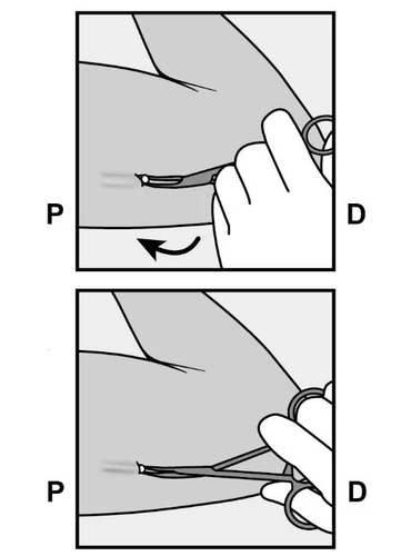 Two illustrations showing hand holding an injection pen at the thigh, with a curved arrow indicating downward movement and injection pen in vertical position