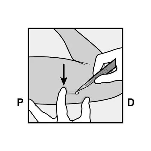 Hand holding an injection pen directed toward the thigh, with fingers of the other hand stabilizing the skin at the site indicated by an arrow marking the injection point