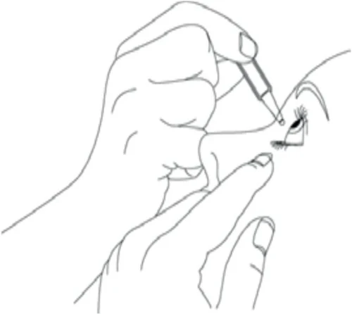 An illustration showing hands holding an eye and using a dropper to administer medication drops directly into a person's eye