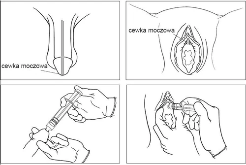 Cztery schematy anatomiczne i medyczne przedstawiające lokalizację cewki moczowej u mężczyzny i kobiety oraz proces podawania leku strzykawką
