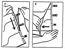 Instrucción esquemática en dos paneles A y B que muestra manos colocando y tensando un vendaje blanco sobre la pierna de un paciente