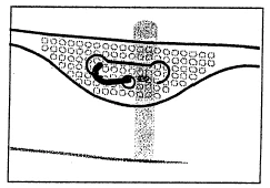 Corte esquemático de tejido con células visibles y una estructura oscura y serpenteante que recuerda a un vaso sanguíneo o fibra dentro de las células