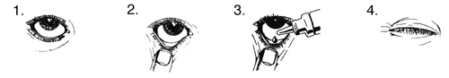 Four-step instruction for administering eye drops: open eye, approaching the dropper to the lower eyelid, instilling the drop, and closed eye