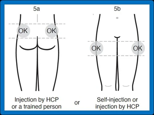 Diagram 5a shows an injection into the buttocks marked OK, and diagram 5b shows an abdominal injection marked OK for administration by a healthcare provider or self-injection