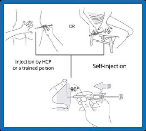 Diagram showing three methods of drug administration: by healthcare personnel into the buttock, self-injection into the thigh, or at a 90-degree angle into the abdomen