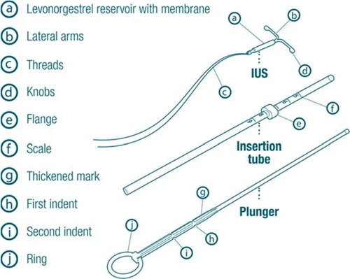 Schematic structure of an IUS with labeled parts: reservoir with membrane, side arms, threads, knobs, collar, scale, markers, and a tube with a plunger for application
