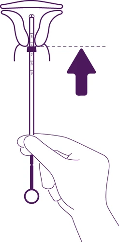 A hand holding a long, vertical medical device with a numerical scale, indicated by a purple arrow pointing upward at level 6
