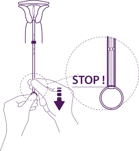 Hands holding a long applicator marked with 'STOP' and an arrow indicating downward movement, along with an enlarged view of the device tip within a circle