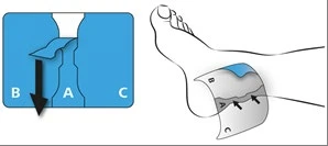 Diagram showing the method of applying a patch to the foot, with labels B, A, C, and a black arrow indicating the direction of application of segment B