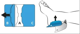 Diagram illustrating the separation of components A, B, and C, and the application of the blue patch B onto the heel to protect and stabilize the area