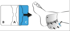 Diagram showing the application of a patch to the foot, where segments A, B, and C form a continuous whole covering the arch and heel of the foot