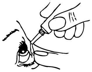 A hand holds a small bottle with a dropper and administers drops directly into a person's eye, with visible eyelashes and eyelid