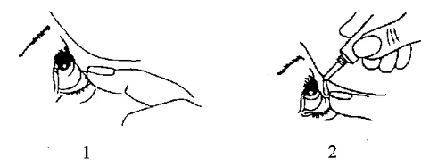 Illustration showing two stages of administering medication to the eye: first, the finger pulls down the lower eyelid, then the dispenser applies a drop to the eye