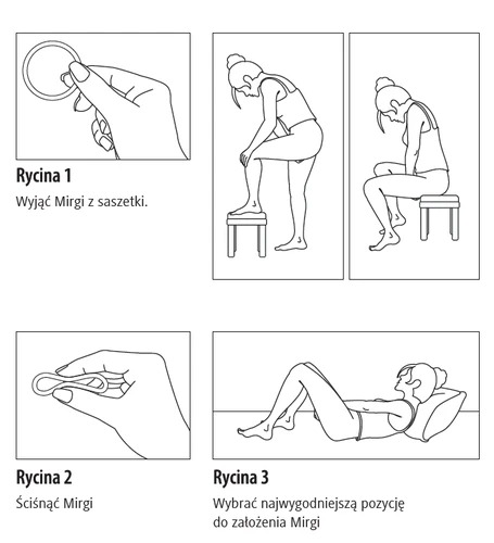 Three illustrative diagrams: a hand removing a Mirena device from a pouch, a hand squeezing the device, and a woman in three sitting and lying positions