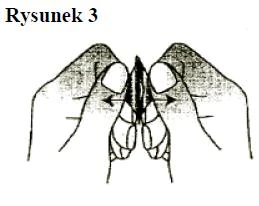Schematic illustration showing two hands separating tissue in opposite directions, indicated by two black arrows
