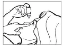 Ilustración que muestra una mano sosteniendo un inhalador y pulverizando el medicamento dentro de la boca abierta de un paciente para su administración oral