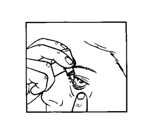 Una mano tiene una piccola boccetta con collirio e applica il farmaco direttamente nell'occhio di una persona, mentre l'altra mano delicatamente tira giù la palpebra inferiore