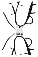 Línea negra simplificada que representa unas manos sosteniendo un elemento médico de forma irregular de color gris sobre fondo blanco