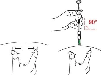 Hand holding a syringe at a 90-degree angle to the skin, with other hands stretching the tissue with fingers prior to injection