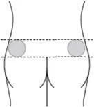 Schematic silhouette of the torso with two gray circles marked on the hips, bounded by horizontal dashed lines at upper and lower levels